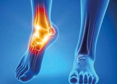 دردهای مفصلی را چطور کم کنیم؟ دردهای مفصلی را چطور کم کنیم؟